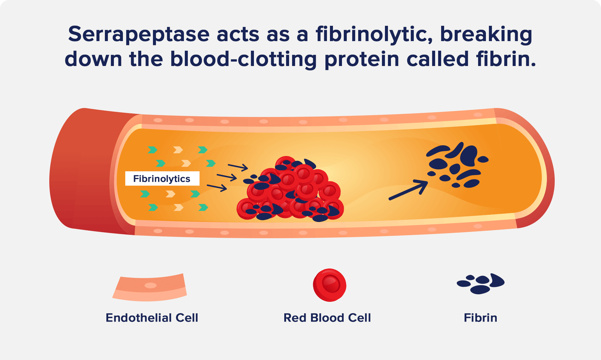 serrapeptase May Lower Risk of Atherosclerosis